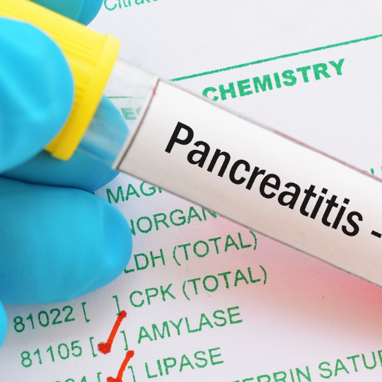 Pancreatitis